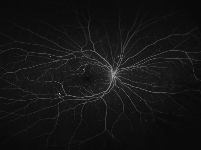 Opthalmology research